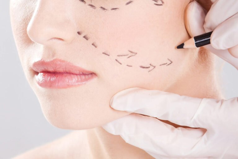 What Steps Should You Take Before Getting Facelift Surgery?